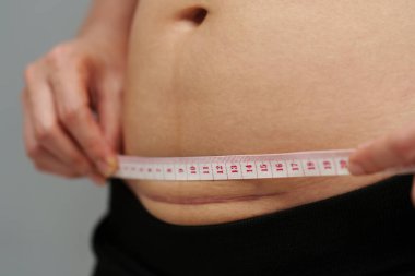 Karnında sezaryenin sezaryen izini ölçen bant kullanan bir kadın.