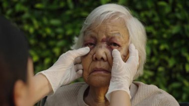 Doktor yaşlı kadının yüzünü ve gözünü kazadan dolayı morluklarla kontrol ediyor.