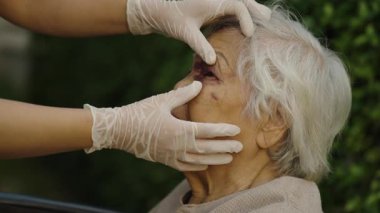 Doktor yaşlı kadının yüzünü ve gözünü kazadan dolayı morluklarla kontrol ediyor.