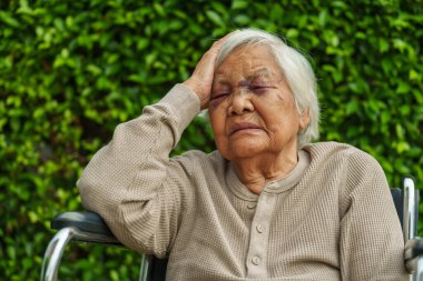 Yaşlı kadın baş ağrısı ve göz kapağında yaralanma ve bir kazadan dolayı burun şişmesi. 