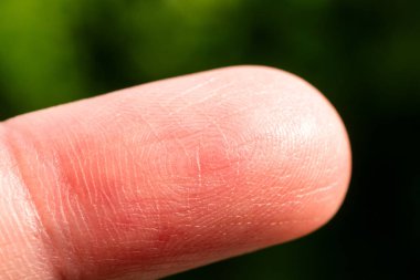 Detaylı bir makro çekim, yemyeşil bir zemine karşı insan parmak ucunun eşsiz dokusunu gösteriyor..