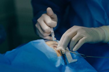 Modern bir klinikte göz ameliyatı. Vizyon düzeltmesi