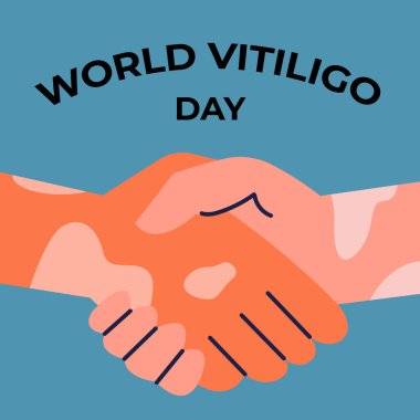 Deri pigmentasyonuyla el sıkışmak deri hastalıklarına karşı verilen mücadelenin bir göstergesi. Dünya Vitiligo Günü. Tıbbi makaleler için düz illüstrasyon. Deri tedavisinin tıbbi konsepti.