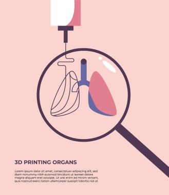 Bir 3D yazıcı akciğerin ikinci kısmını yazdırır. 3 boyutlu organ baskısı. Geleceğin tıbbı. Düz vektör illüstrasyonu.