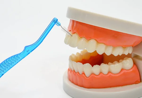 Μια Μπλε Οδοντιατρική Οδοντόβουρτσα Και Ένα Μοντέλο Δοντιού Λευκό Φόντο — Φωτογραφία Αρχείου