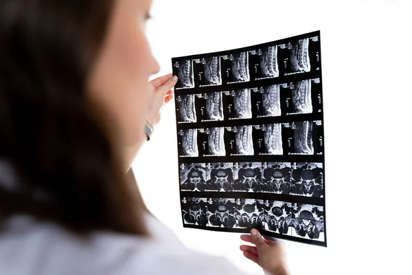 Une Femme Médecin Regarde Une Photo Radiographique Concept Hôpital Médecin — Photo