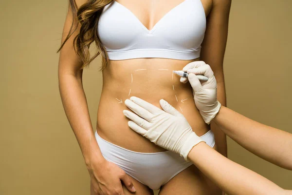 Çamaşırlı Latin Bir Kadının Karnına Estetik Ameliyat Liposuction Yaptırırken — Stok fotoğraf