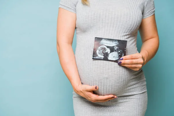 Studio Shot Belly Pregnant Woman Ultrasound Picture Some Copy Space — Stock Photo, Image