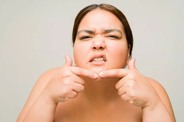在使用护肤护理时 肥胖的女人一边挤压粉刺 一边苦于痤疮 进行眼神交流 — 图库照片