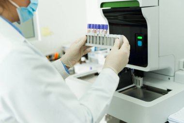 Tıbbi laboratuardaki ekipmanları kullanarak test tüplerinde kan örnekleriyle çalışan bir laboratuvar teknisyenini kapatın.