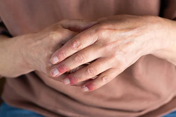 Închiderea Mâinilor Femeilor Vârstnice Dermatită Atopică Eczeme Reacții Alergice Pielea — Fotografie, imagine de stoc