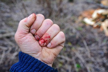 Beyaz arka planda sol yumruk. Adamın kanlı yumrukları. .