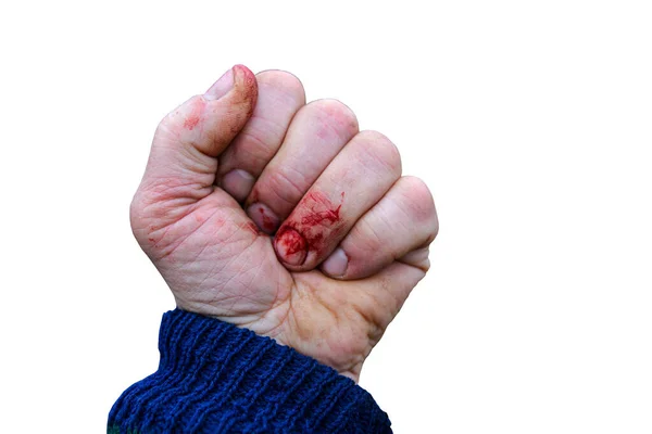 left fist on white background .Man\'s fists with blood .
