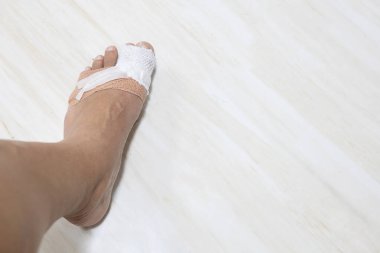 Tıbbi bandaj ve gazlı bezle sarılı yaralı bir ayak parmağıyla insan ayağı.