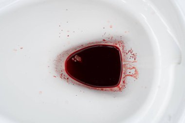 Basur kaynaklı kan ya da sifondaki regl. Hemoroidler yüzünden kanayan taburelerden sonra sifonu temiz. Basur kaynaklı kan ya da sifondaki regl..