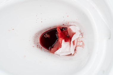Basur kaynaklı kan ya da sifondaki regl. Hemoroidler yüzünden kanayan taburelerden sonra sifonu temiz. Basur kaynaklı kan ya da sifondaki regl..