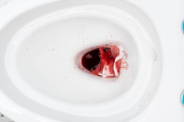 Basur kaynaklı kan ya da sifondaki regl. Hemoroidler yüzünden kanayan taburelerden sonra sifonu temiz. Basur kaynaklı kan ya da sifondaki regl..