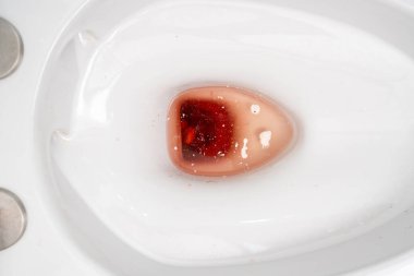 Hemoroit merhemi fitilleri, tuvaletteki basur kanaması.