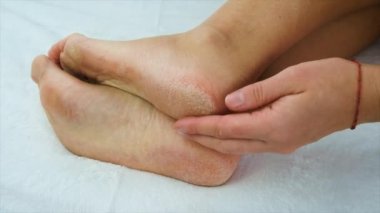 Dişi ayaklarının kuru derisi. Seçici odaklanma. İnsanlar.