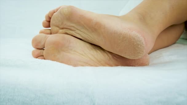 Ξηρό Δέρμα Γυναικείων Ποδιών Επιλεκτική Εστίαση Άνθρωποι — Αρχείο Βίντεο