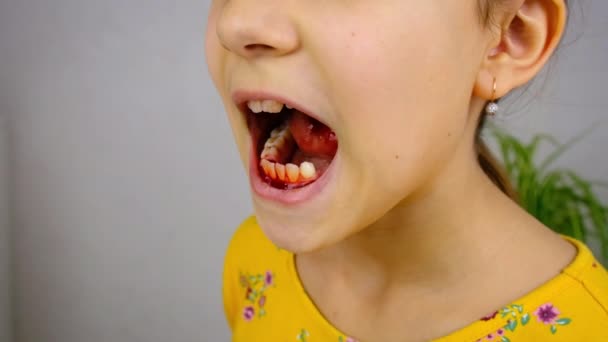 Vytrhnout Dětský Zub Selektivní Zaměření Dítě — Stock video
