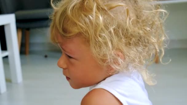 子供は蚊に噛まれて腫れた目をしている 選択的な焦点 キッド キッド — ストック動画