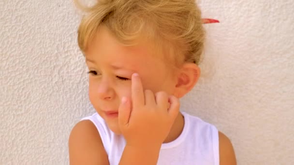 Uma Criança Tem Olho Inchado Uma Picada Mosquito Foco Seletivo — Vídeo de Stock