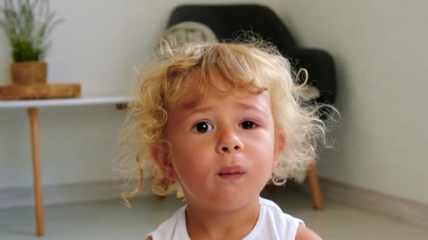 Een Kind Heeft Een Gezwollen Oog Van Een Muggenbeet Selectieve — Stockvideo