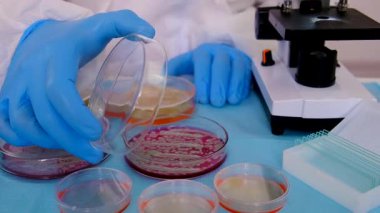 Laboratuvardaki petri kabındaki bakterileri inceleyin. Seçici odaklanma. Doğa.