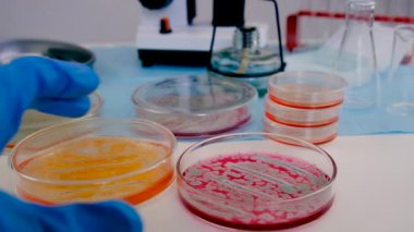 Laboratuvardaki petri kabındaki bakterileri inceleyin. Seçici odaklanma. Doğa.
