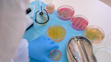 Laboratuvardaki petri kabındaki bakterileri inceleyin. Seçici odaklanma. Doğa.