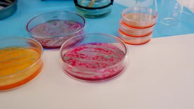 Laboratuvardaki petri kabındaki bakterileri inceleyin. Seçici odaklanma. Doğa.