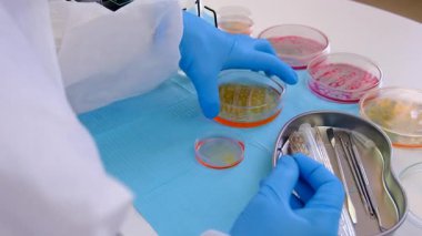 Laboratuvardaki petri kabındaki bakterileri inceleyin. Seçici odaklanma. Doğa.