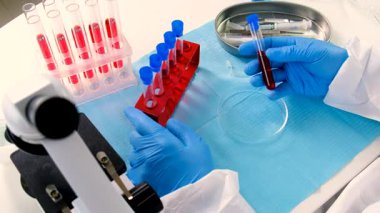 Laboratuvardaki kanı incele. Seçici odaklanma. ilaç.