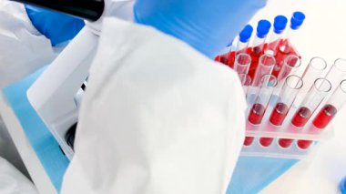 Laboratuvardaki kanı incele. Seçici odaklanma. ilaç.