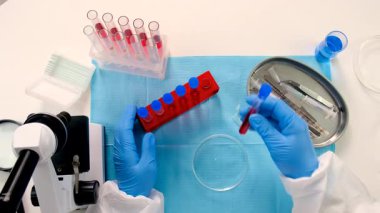 Laboratuvardaki kanı incele. Seçici odaklanma. ilaç.