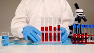 Laboratuvardaki kanı incele. Seçici odaklanma. ilaç.