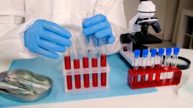 Laboratuvardaki kanı incele. Seçici odaklanma. ilaç.