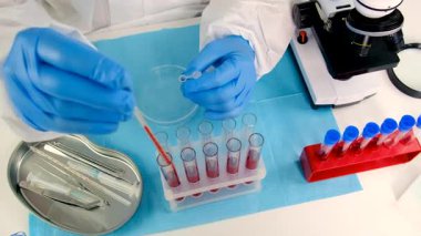 Laboratuvardaki kanı incele. Seçici odaklanma. ilaç.