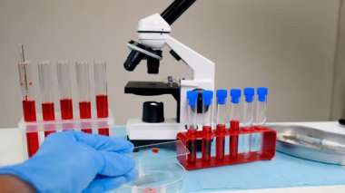 Laboratuvardaki kanı incele. Seçici odaklanma. ilaç.