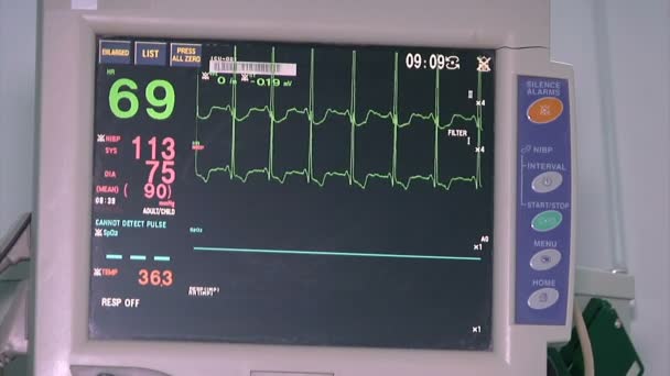 Ekg Heart Monitor Medical Ekg Heart Rate Monitor Hospital — Stok video
