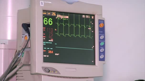 Ekg Heart Monitor Medical Ekg Heart Rate Monitor Hospital — стокове відео