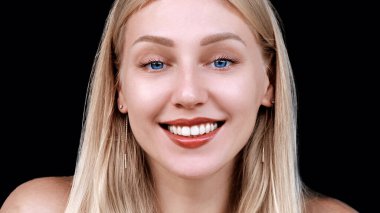 White teeth, veneers, dentistry. Headshot portrait of a young woman with a wide white smile. Beautiful caucasian blonde looking at the camera with veneers in her mouth