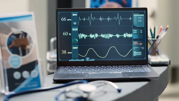 心拍数分析のための心臓グラムを実行して 空のフロントデスクでラップトップ上でハートビート 診断のためのパルス圧力を示すPcと空の診断センターカウンター 手持ち撮影 閉じろ — ストック写真