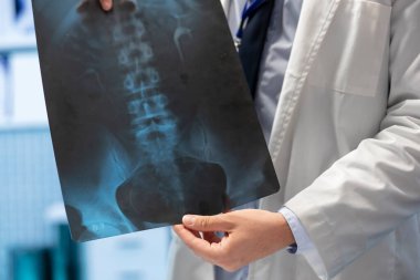 Sağlık uzmanlarını toplayan pratisyen hekim özel bir klinik toplantısında röntgen taramalarını inceliyor. Lisanslı uzmanlar teşhis ve hastalık önleme, işbirlikçi takım çalışması üzerinde çalışıyorlar. Kapat..