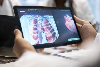 Doktorlar ve hemşireler bir tedavi merkezinde akciğer radyografisi hakkında konuşmak için toplanırlar. Tıbbi ekip teşhis için röntgen ve sağlık kayıtlarını analiz ediyor. Kapat..