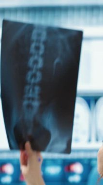 Dikey Video Sağlık Uzmanı, tıbbi uzmanlığını ofisteki bir hastayla paylaşıyor, röntgen ve MRI taramalarını inceliyor ve doğru tanı ve hasta bakımına odaklanıyor. Tıbbi hizmetler