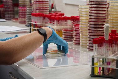 eli olan bir sıhhiye analiz için veri toplamak için petri kabını manipüle eder, laboratuvar çalışması sırasında tıbbi kaplar ve ekipmanlar, yakın çekim