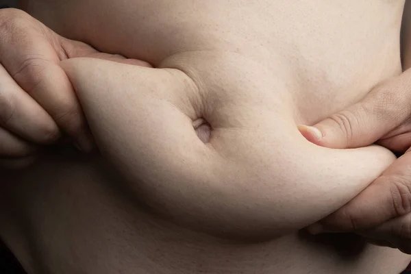 Lose belly fat concept: man pinch his belly to show his belly fat