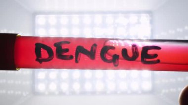 Doktor bir dang virüsü numunesiyle test tüpünü sallıyor.